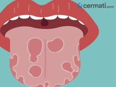 Artikel Manajemen Keuangan - Cermati