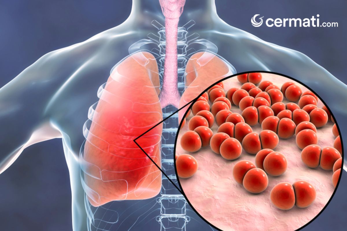 Menyangka Pneumonia Sama Dengan Corona Inilah Perbedaan Hingga Gejala Pneumonia Cermati Com
