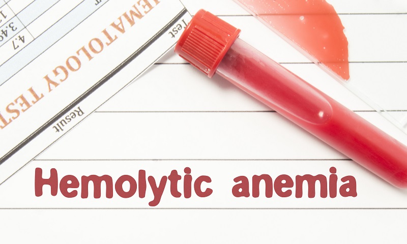 anemia hemolitik