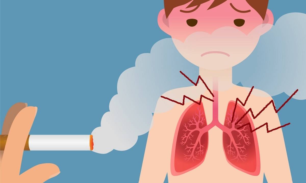 Seorang perokok aktif berpotensi mengalami gangguan pada organ tubuh organ tubuh yang pertama kali rusak akibat asap rokok ialah
