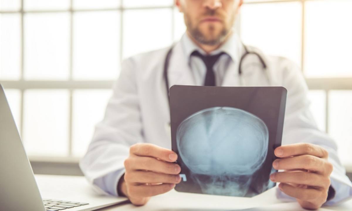 Sakit Kepala Penyebab Sakit Kepala Dan Cara Menghilangkan Sakit Kepala Yang Perlu Kamu Tahu Cermati Com