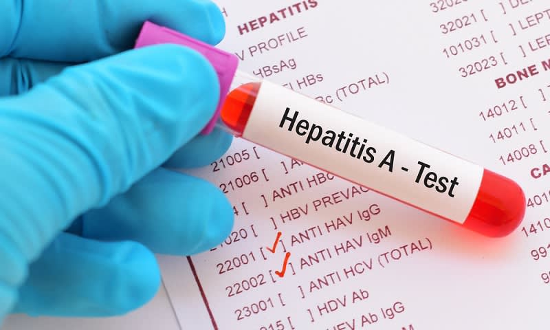 hepatitis A