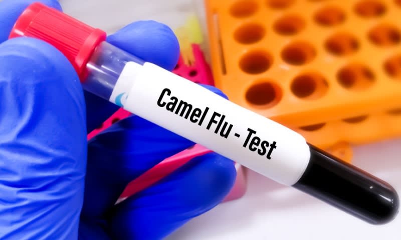 flu unta