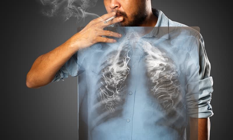 Penyakit kanker paru-paru