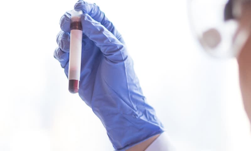 Tes Darah adalah Salah Satu Langkah Apakah Anda Terkena Tipes atau Tidak