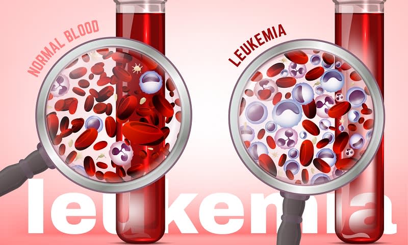 leukemia